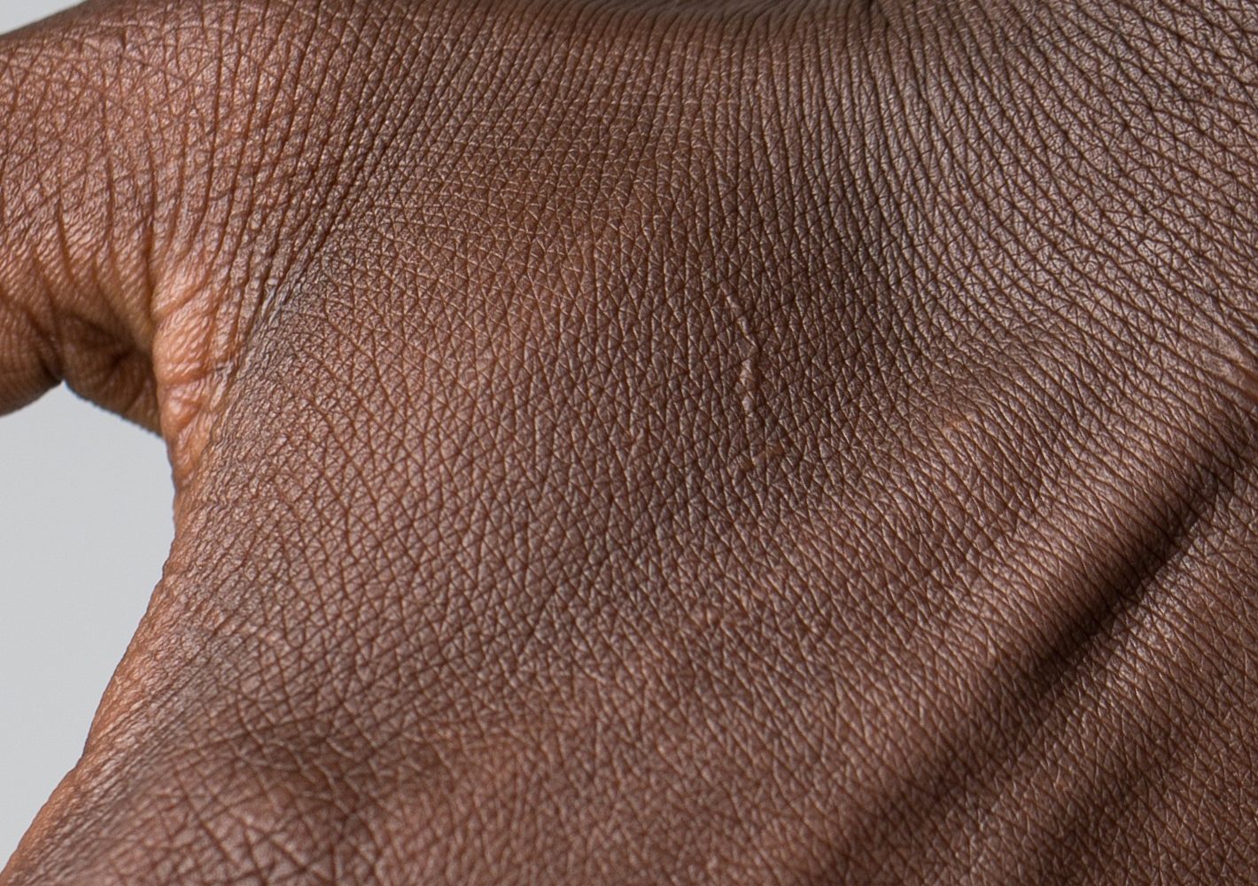 Extreme close-up of the natural texture and fine lines of skin on the back of a hand.